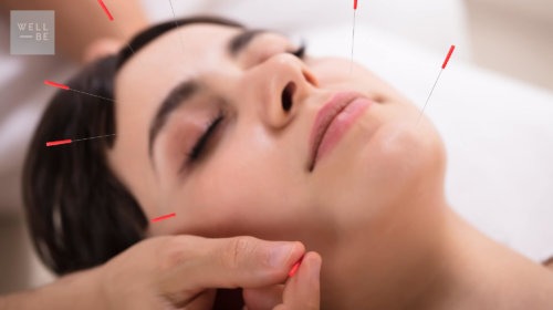 The WellBe Guide to Acupuncture: All the Acupuncture Facts You Need to Know