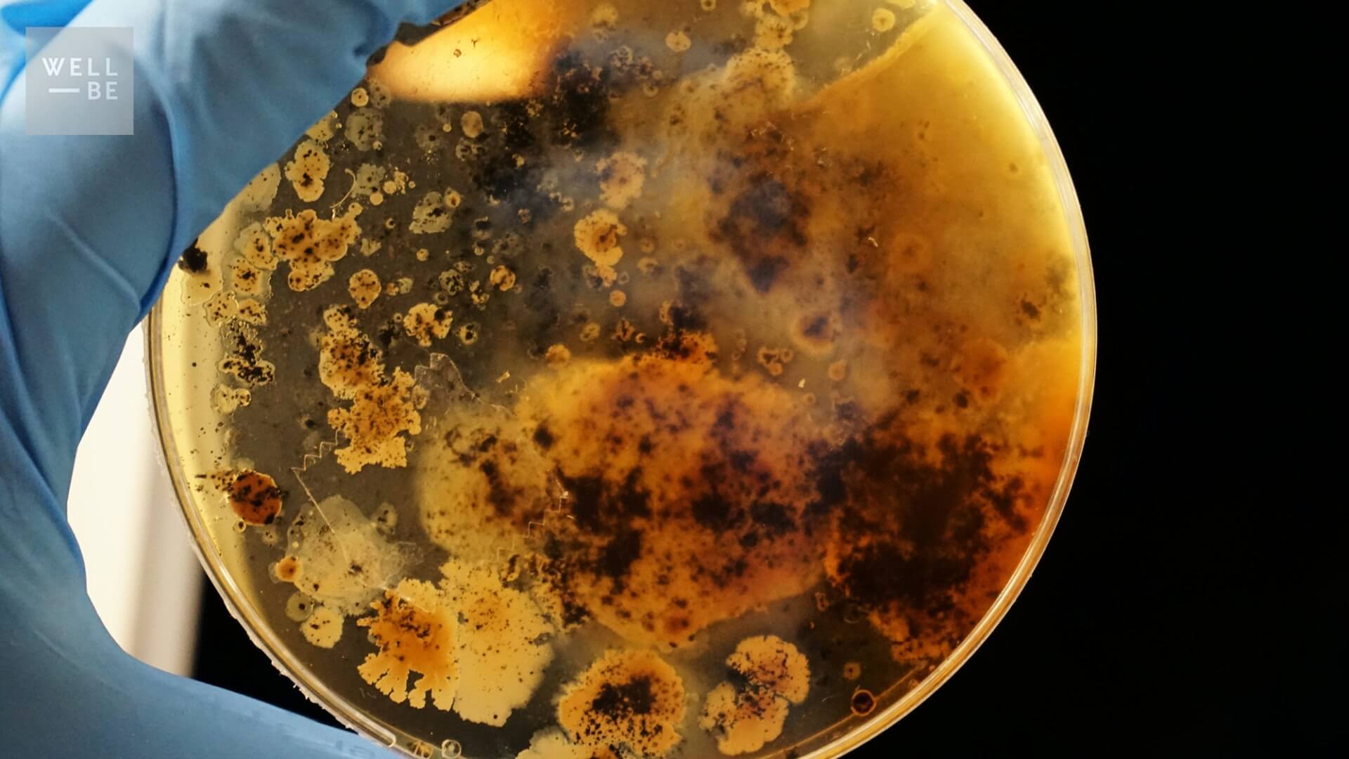 yeast overgrowth under a microscope